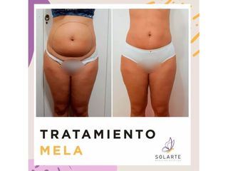 MELA