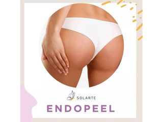ENDOPEEL 