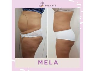 Mela