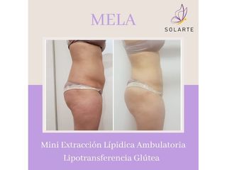 MELA - Dra. Haylen Lozano Solarte