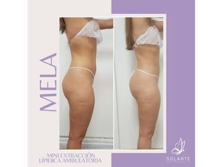 MELA - Dra. Haylen Lozano Solarte