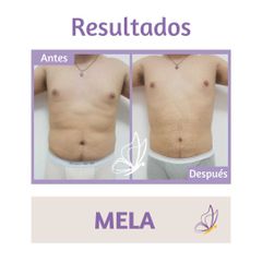 MELA - Dra. Haylen Solarte
