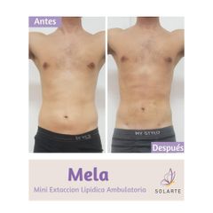 MELA - Dra. Haylen Solarte