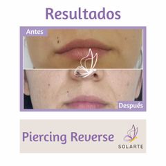 Piercing reverse - Dra. Haylen Solarte