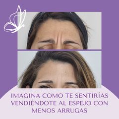 botox - Dra. Haylen Solarte