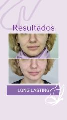 Long Lasting - Dra. Haylen Solarte