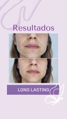 Long Lasting - Dra. Haylen Solarte