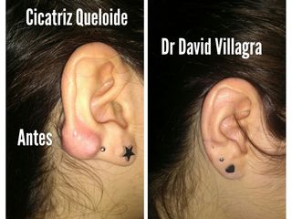 Dr. David Villagra - Cirujano Plástico 