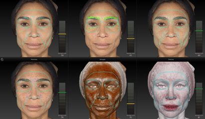 Análisis de piel 3D con Vectra - Rejuvenecimiento Facial - Alma Estética - Dra. Mariela Orgueira