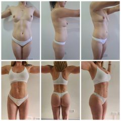 Lipoescultura HD - Dra. Paula Granero