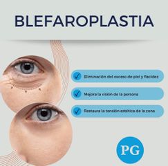Blefaroplastia, Dra. Paula Granero
