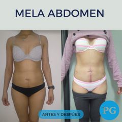 MELA - Dra. Paula Granero