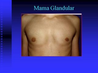 diapositiva2