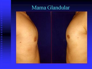 diapositiva3