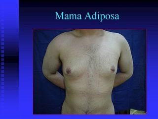 diapositiva4