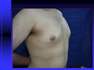 diapositiva5