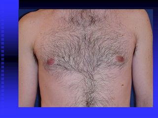 diapositiva7