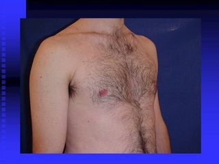 diapositiva9