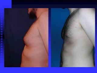 diapositiva11