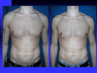 diapositiva12