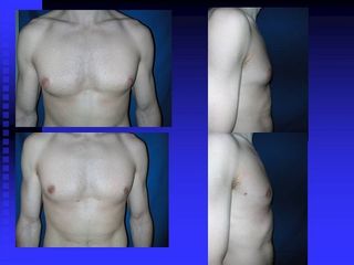 diapositiva13