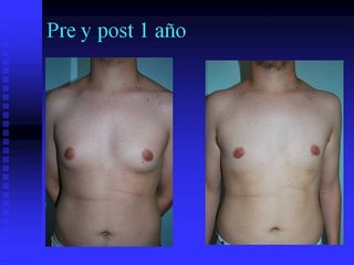 diapositiva14