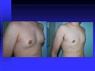 diapositiva15