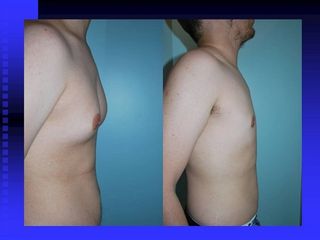 diapositiva16