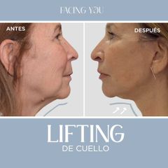 Lifting - Dr. Cristian Schauvinhold