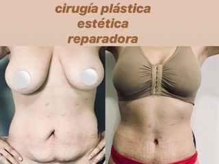 Cirugía reparadora