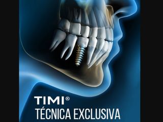 Técnica TIMI®