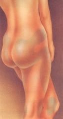Lipoescultura
