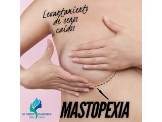 Mastopexia