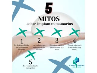 5 mitos sobre implantes mamarios