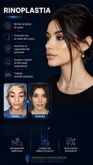 Rinoplastia - Dr. Rodolfo Villavicencio