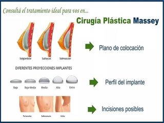 Qué tenés que saber previo a la Cirugía de Aumento Mamario?