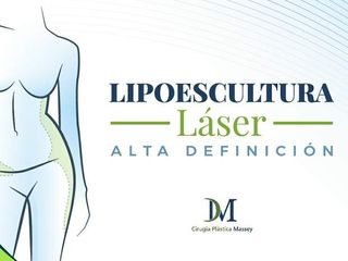 Lipoescultura Laser de Alta Definición