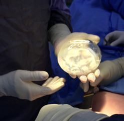 Prótesis de silicona
