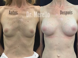 Dr. Alejandro J Merello Abente 