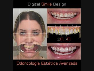 Ortodoncia-645346