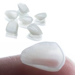 Fragmentos-ceramicos-carillas - AM Estética Dental