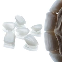 Fragmentos-ceramicos - AM Estética Dental