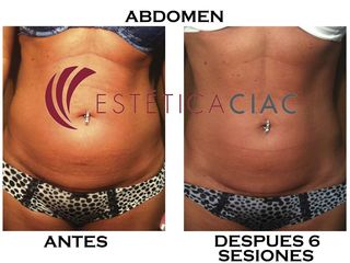 A&D ABDOMEN EC2018