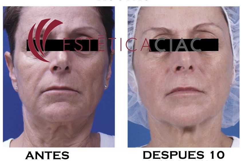 Medicina Ortomolecular antes y después - 634046