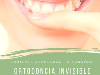 Brackets invisibles - Ortodoncia en Córdoba - Mejora tu estética dental