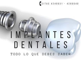 Implantes Dentales Córdoba - COP Consultorios Odontológicos Córdoba - Clínica Dental Córdoba - Odont