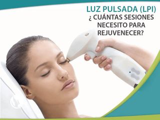 Luz Pulsada - Rejuvenecimiento Facial