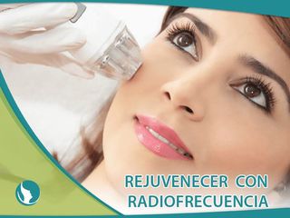 Rejuvenecimiento con Radiofrecuencia 