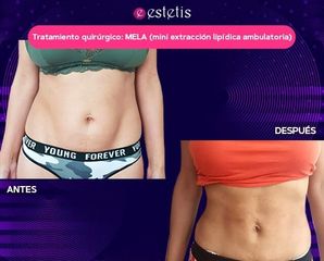 Mela - Estetis