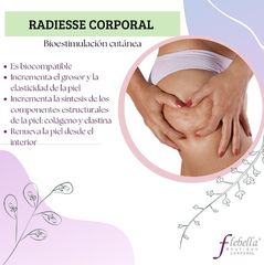 radiesse corpo Flebella